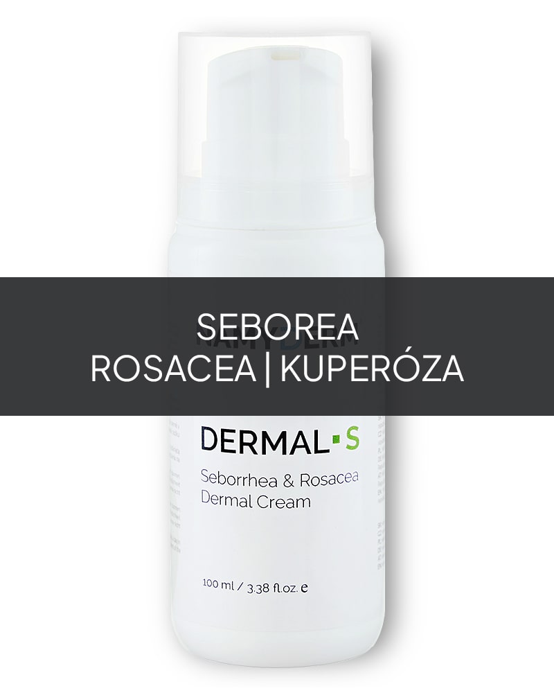 Dermal S – prírodný dermálny krém. Seborea, rosacea a kuperóza